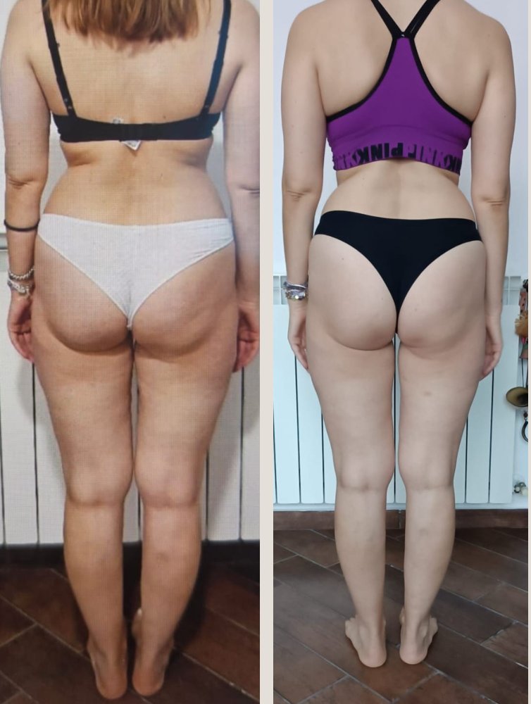 Alina: prima e dopo